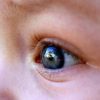 Researchers develop phone app that  can detect eye disease through photos