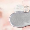 Engineers say self-charging pacemakers could be available in 5 years